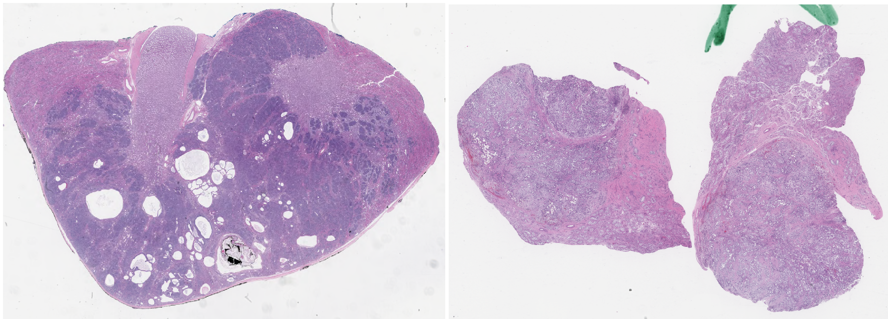 Two example digital pathology tissue slides
